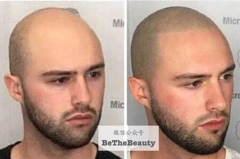 想要「换发型等于换头」?看这简单3步就可以