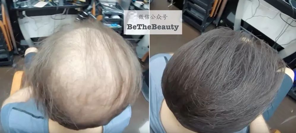 想要「换发型等于换头」?看这简单3步就可以