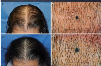 想要「换发型等于换头」?看这简单3步就可以