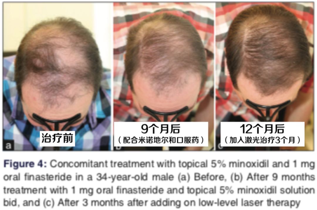 想要「换发型等于换头」?看这简单3步就可以