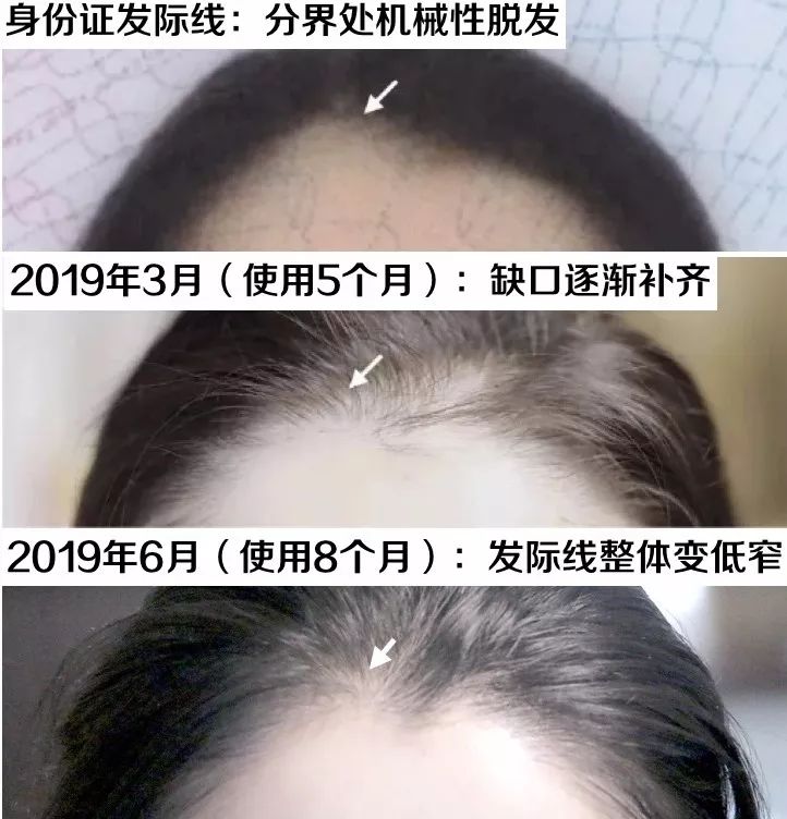 想要「换发型等于换头」?看这简单3步就可以