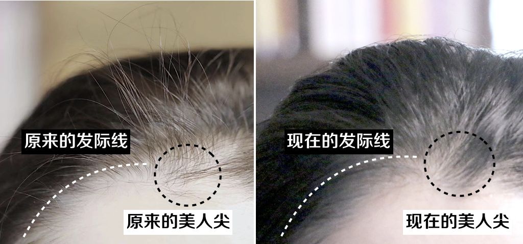 想要「换发型等于换头」?看这简单3步就可以