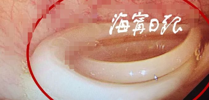 女子肚子疼上医院一查,女子肚子疼去医院检查吓到医生