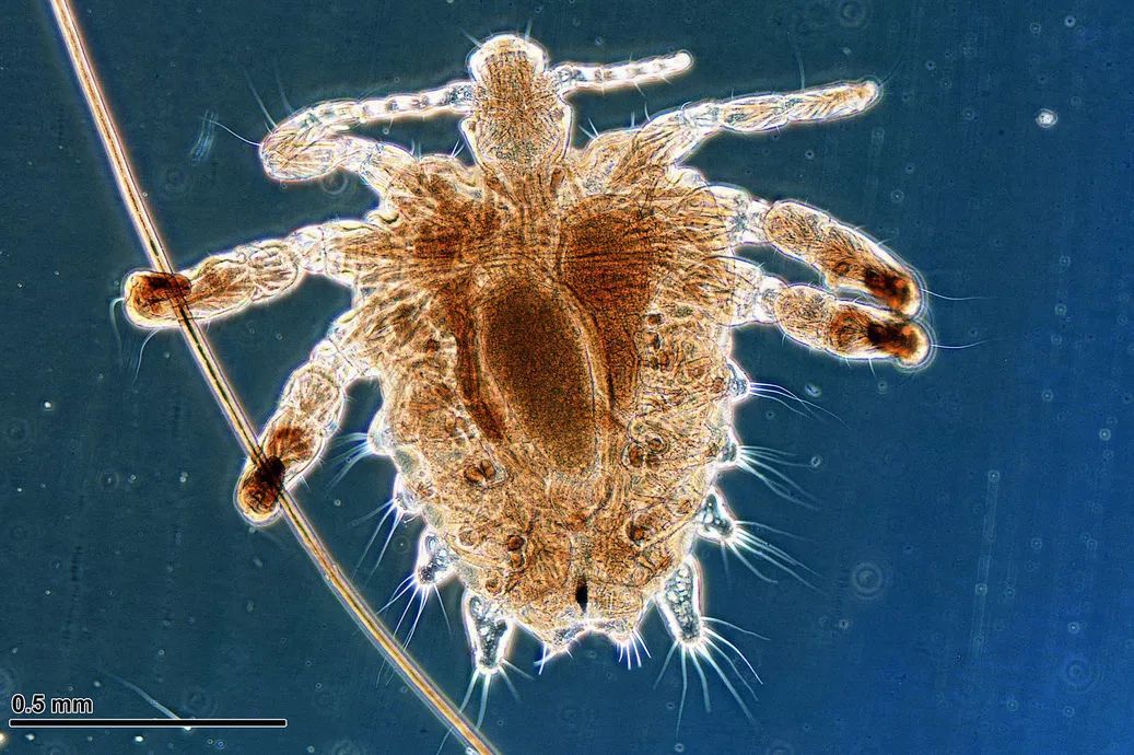 和隐翅虫差不多的黑色吸血虫,少见的吸血虫