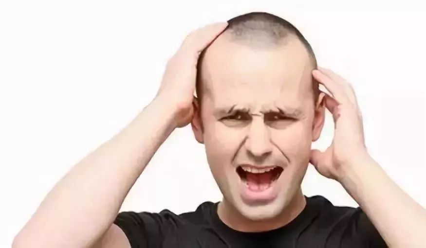 地中海头发改善视频,头发浓密但是有斑秃