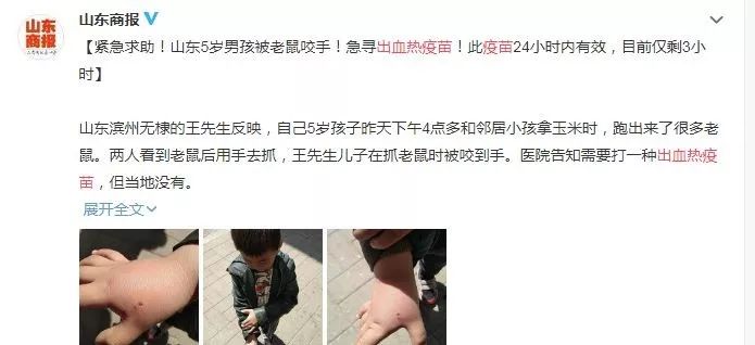 被老鼠咬后多少天内打疫苗有效,被老鼠咬了石家庄哪里能打疫苗