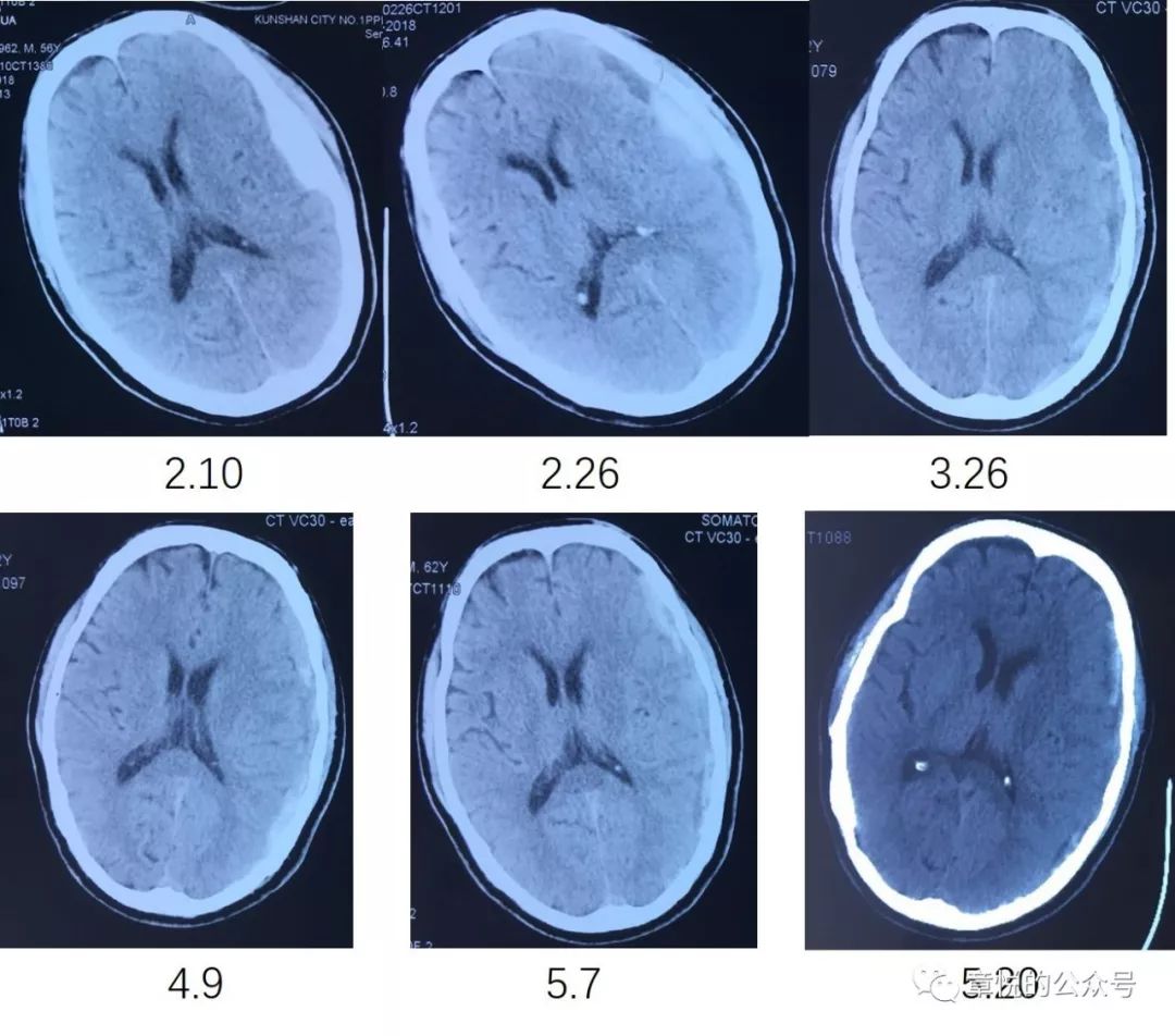「章悦故事汇」华山“一针灵”