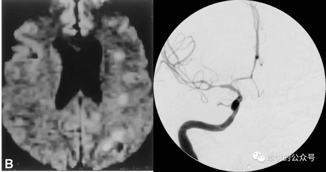 「章悦故事汇」华山“一针灵”