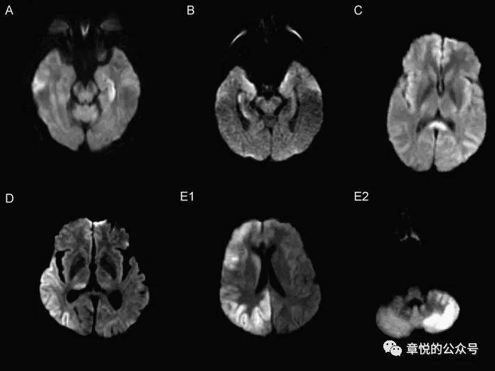 「章悦故事汇」华山“一针灵”