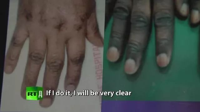 大s曝瘦20斤,大s极端减肥