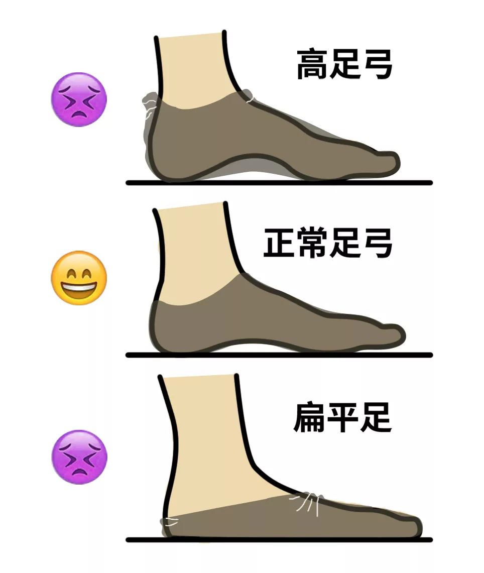 走路袜子往下掉怎么办,走路掉鞋妙招