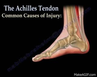 杜兰特跟腱断裂为什么还那么厉害,杜兰特跟腱断裂重回赛场