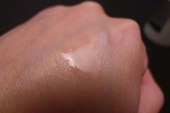 皮肤粗糙暗沉毛孔粗要做什么医美,真正改变毛孔的医美