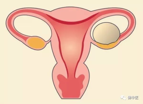绝经八年多了查出卵巢囊肿严重吗,警惕卵巢囊肿恶变