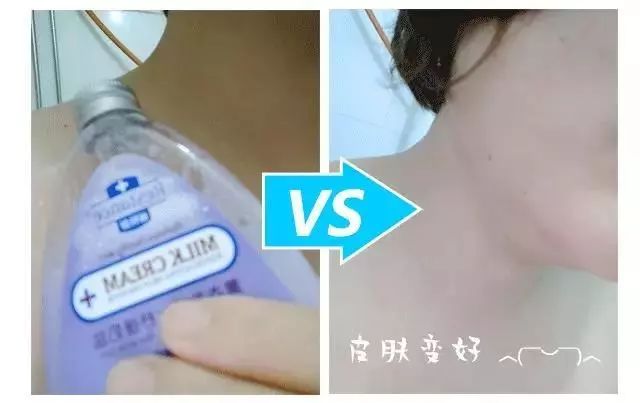 鸡皮肤怎么穿露背装,短期内快速去除鸡皮肤