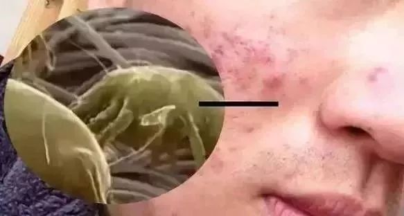 蚕丝被被曝光了！长期盖蚕丝被的人发生了惊人变化...没看的赶紧看看吧