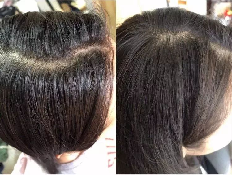 团|你的头发一根都不许掉！用它，还能3天不洗头依然干爽不油腻