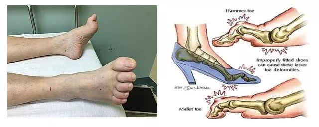 高跟鞋避坑指南,高跟鞋避坑