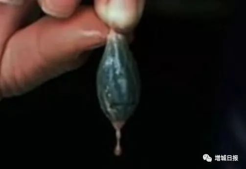 一男子用民间偏方治病险送命!这些偏方都是血淋淋的教训,千万别信