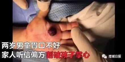 一男子用民间偏方治病险送命!这些偏方都是血淋淋的教训,千万别信