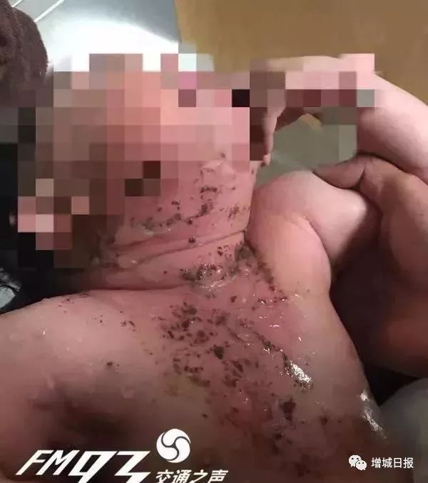 一男子用民间偏方治病险送命!这些偏方都是血淋淋的教训,千万别信