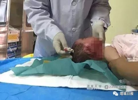 一男子用民间偏方治病险送命!这些偏方都是血淋淋的教训,千万别信