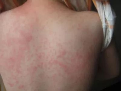 它的菌含量居然是马桶的530倍，你还在每天用