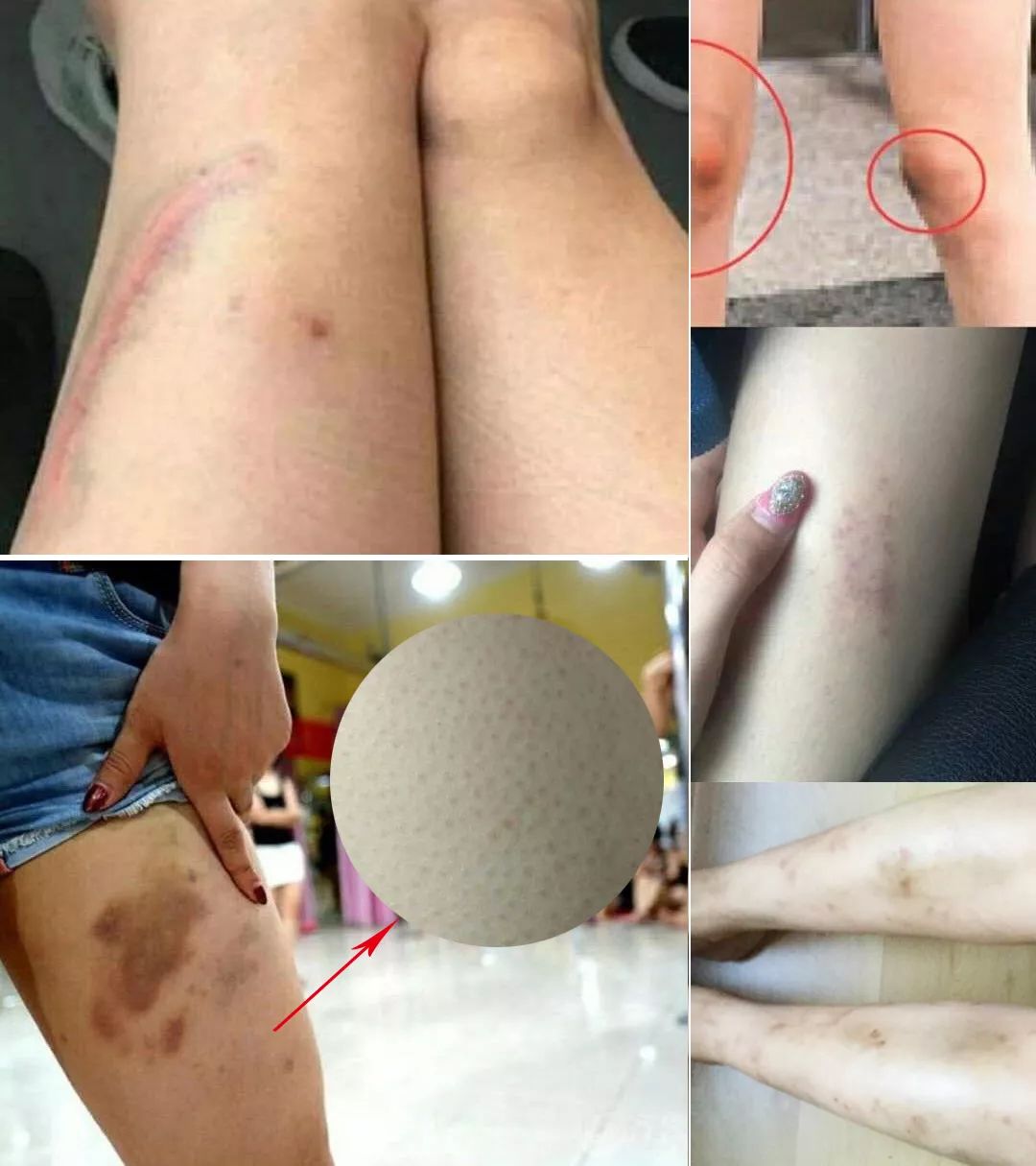 液体*袜丝**是什么鬼?用过的妹子都尖叫!黑腿瑕疵都没了