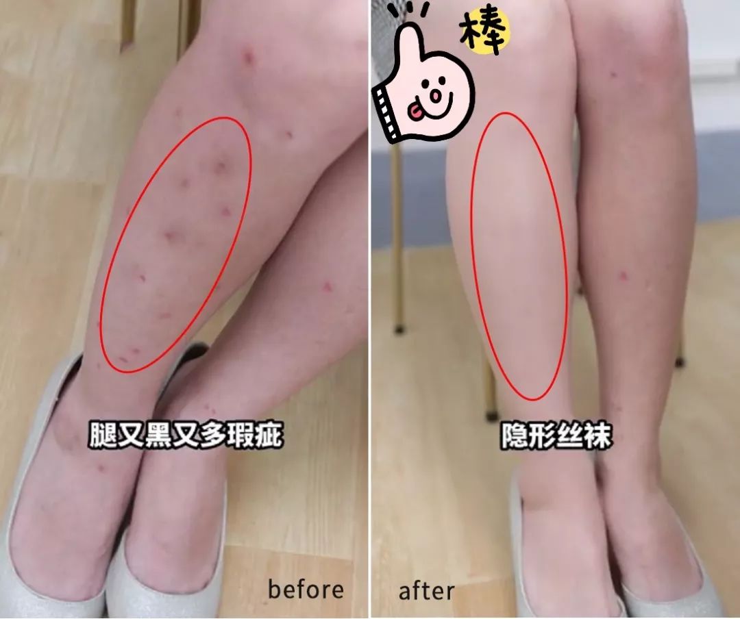 液体*袜丝**是什么鬼?用过的妹子都尖叫!黑腿瑕疵都没了