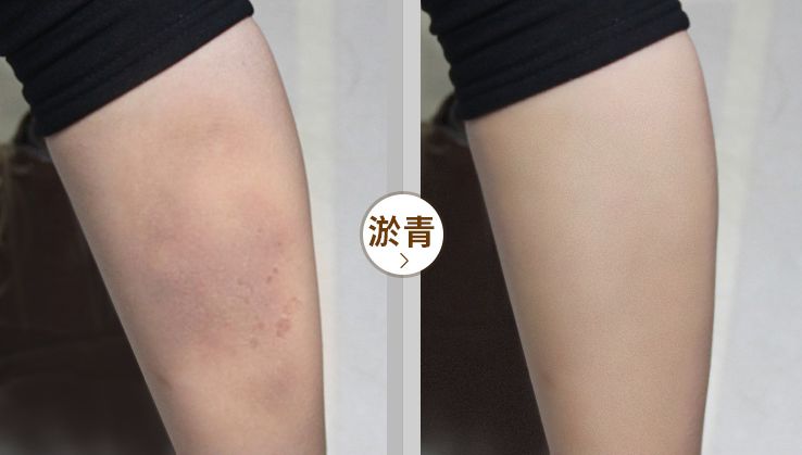 液体*袜丝**是什么鬼？用过的妹子都尖叫！黑腿瑕疵都没了