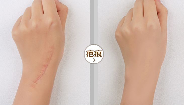 液体*袜丝**是什么鬼？用过的妹子都尖叫！黑腿瑕疵都没了