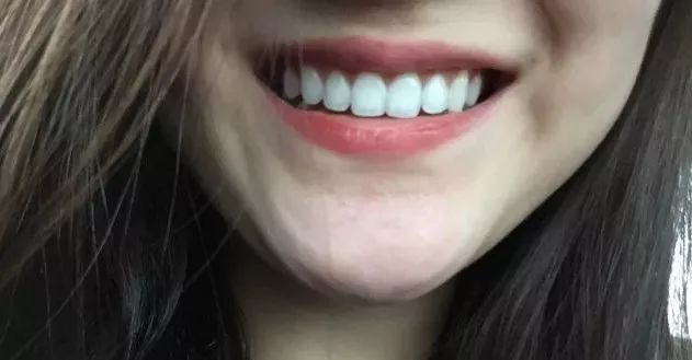 好物丨用它30秒吐掉嘴里所有脏东西，连呼吸都是水果味