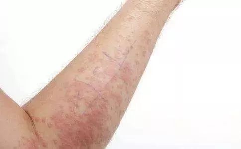 秋季使用花露水的禁忌,夏季花露水