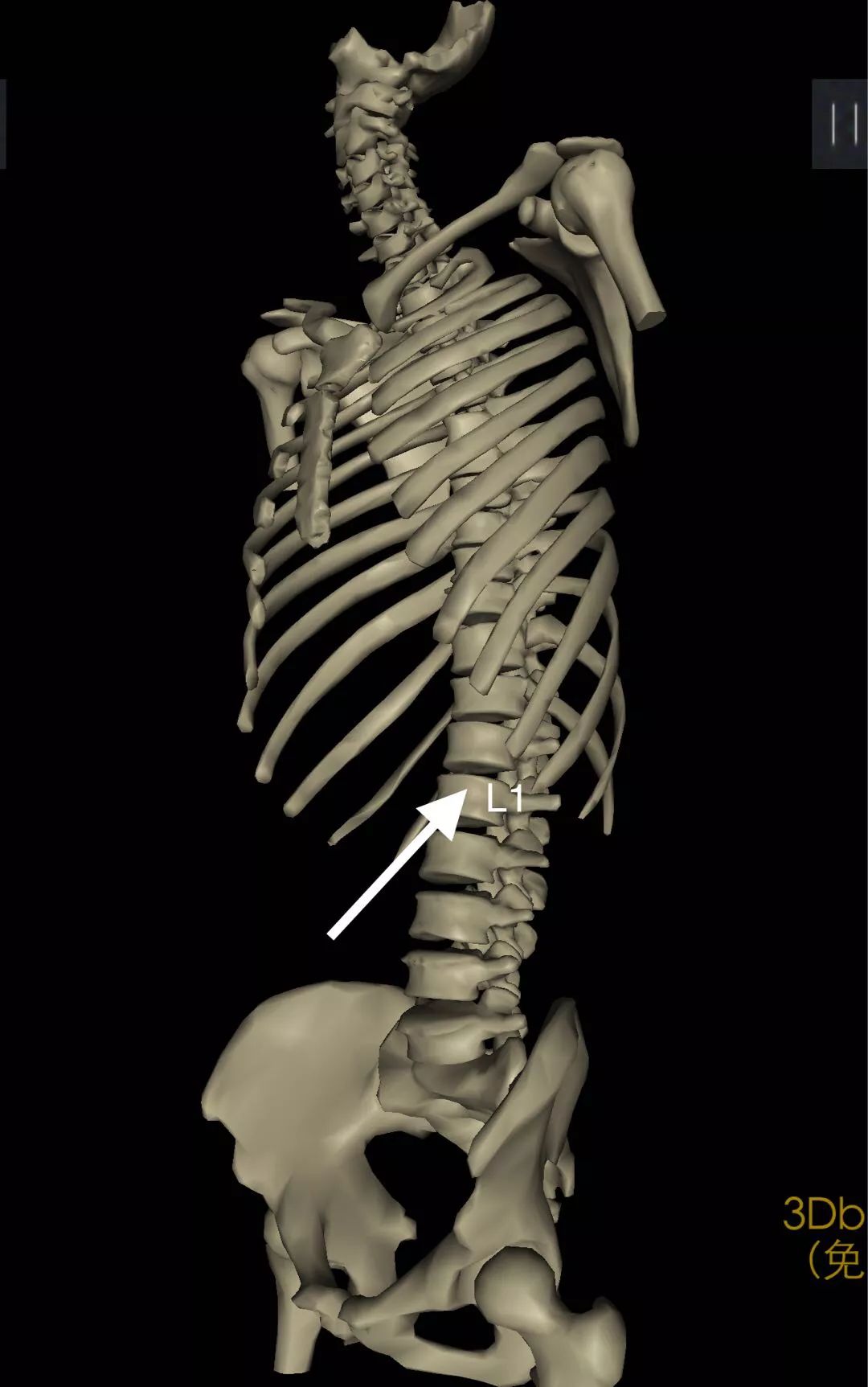 骨科科普压缩性骨折,陈旧性压缩骨折和新近压缩骨折
