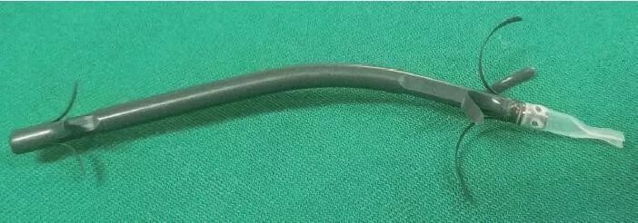 梗阻性黄疸做了胆道支架,胆道梗阻性黄疸胆管穿刺引流