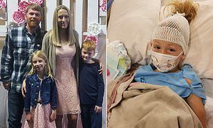 女孩被多蚊叮咬后变异,蚊虫叮咬会得癫痫病吗