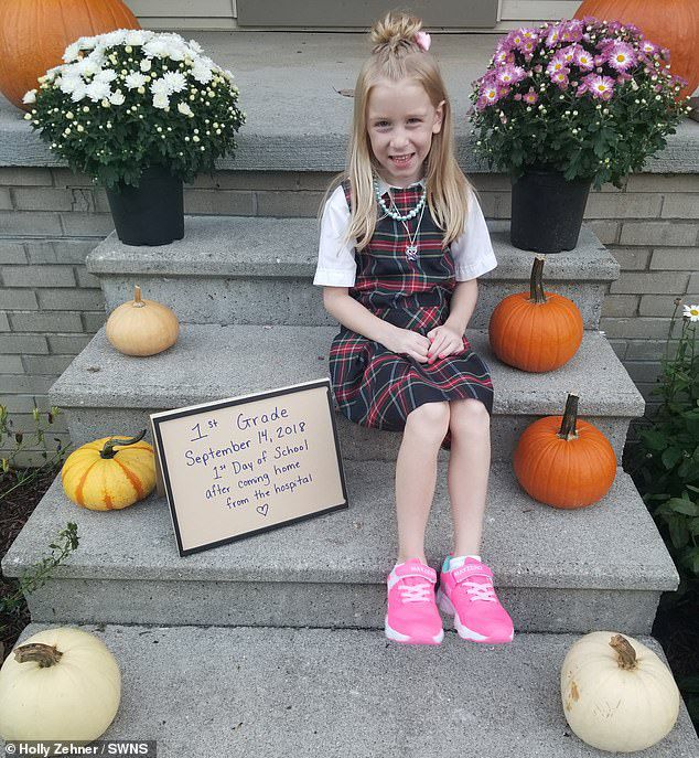 女孩被多蚊叮咬后变异,蚊虫叮咬会得癫痫病吗