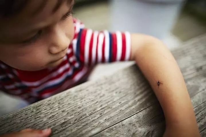 10个月了宝宝左手肿,1岁宝宝手肿得像馒头