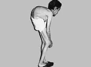 南京一学校大米有镉,大米中镉超标属于什么危害