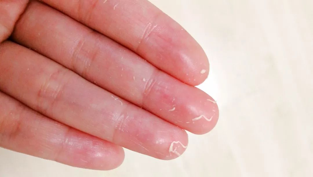 适合油皮的防晒哪款最好用,这些年用过好用的防晒霜还有吗