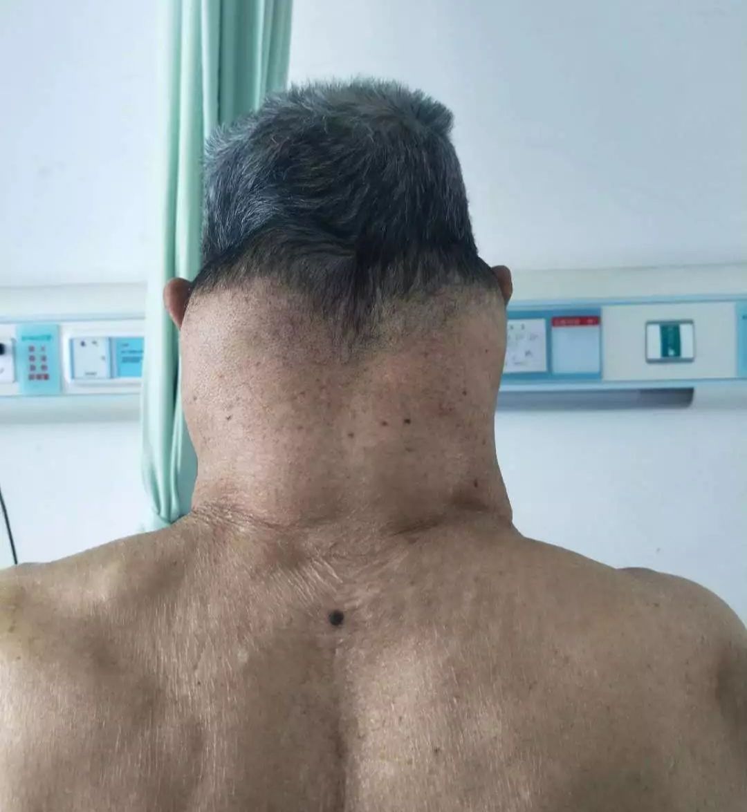 喝饮料变成绿巨人,喝了一瓶水变成绿巨人