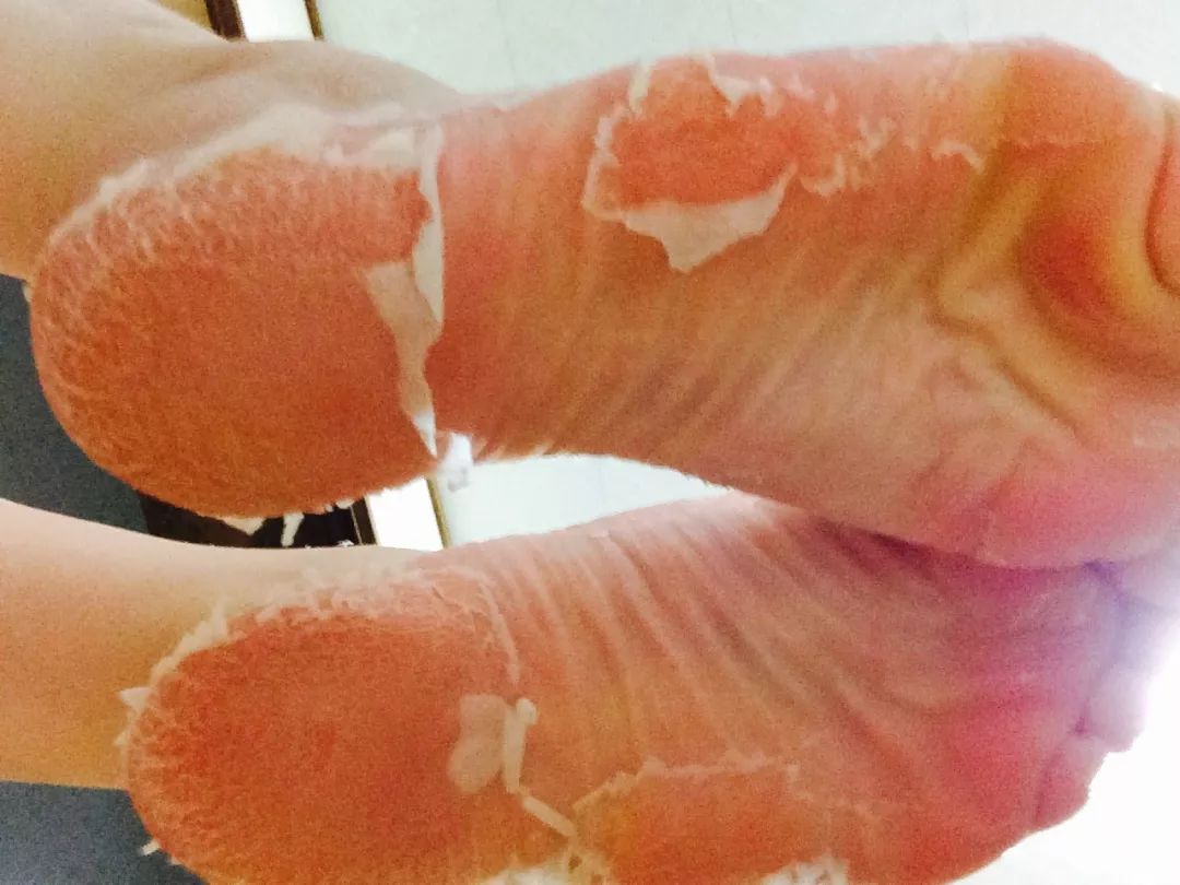 嫩脚神器告别死皮,脚死皮神器第一名