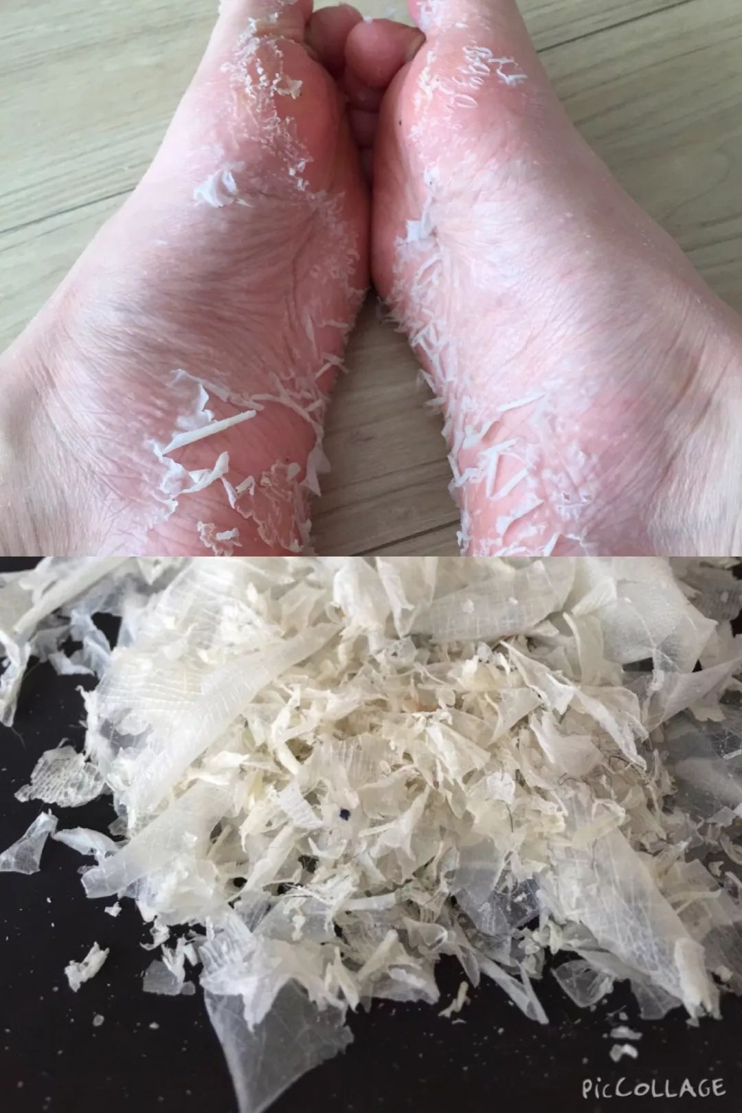 嫩脚神器告别死皮,脚死皮神器第一名