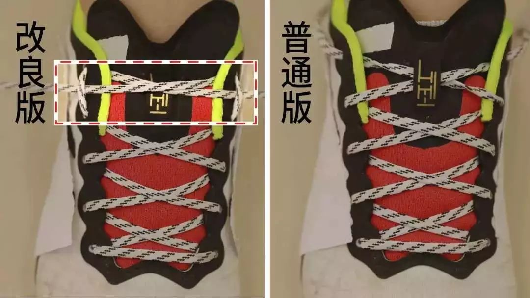 袜子总是往下掉小窍门,袜子老是脱落有什么办法补救