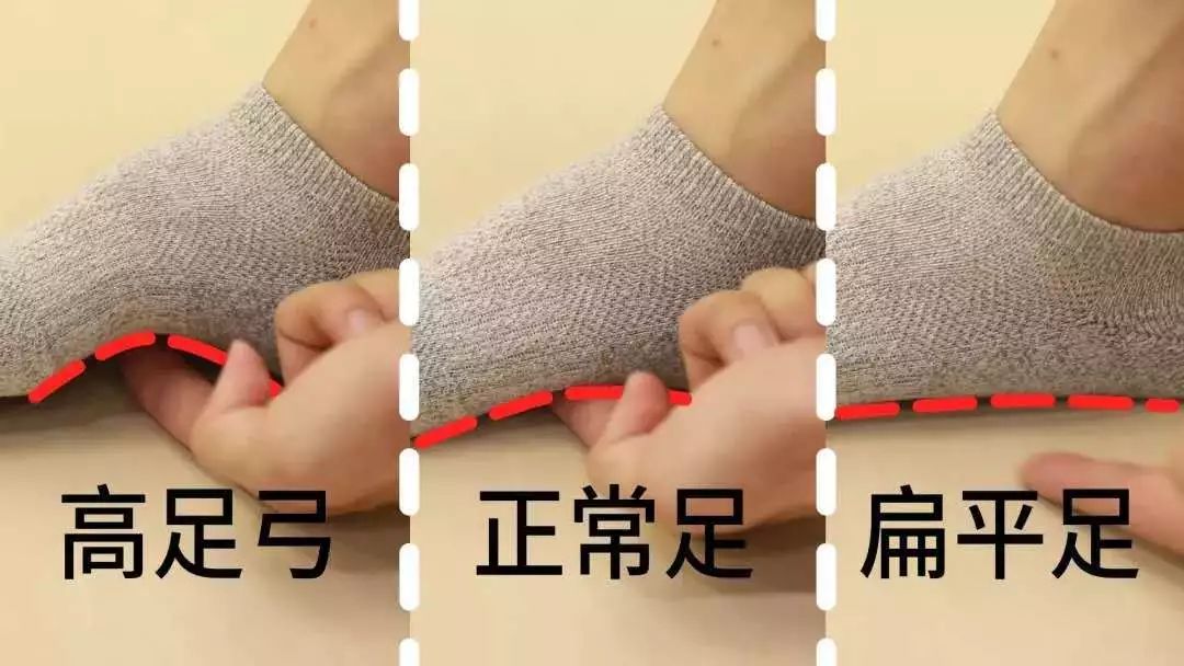 袜子总是往下掉小窍门,袜子老是脱落有什么办法补救