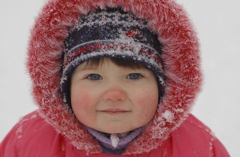 脸上的红血丝怎么处理,脸上的红血丝怎么解决