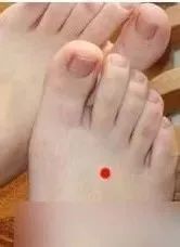 头疼前额疼左右头顶疼,前额到头顶头痛警惕四种原因