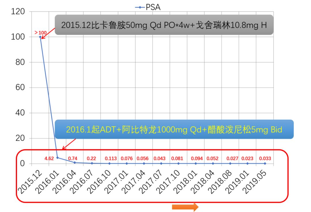 前列腺癌化疗指南,激素敏感转移性前列腺癌化疗方案