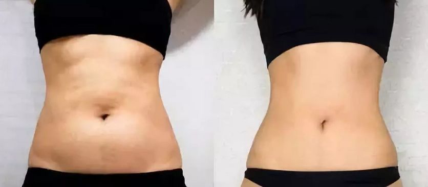 假期结束如何摆脱假期综合症,如何缓解和应对假期综合症