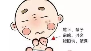 一夏季皮肤病轮番上阵如何应对,皮肤病如何避免